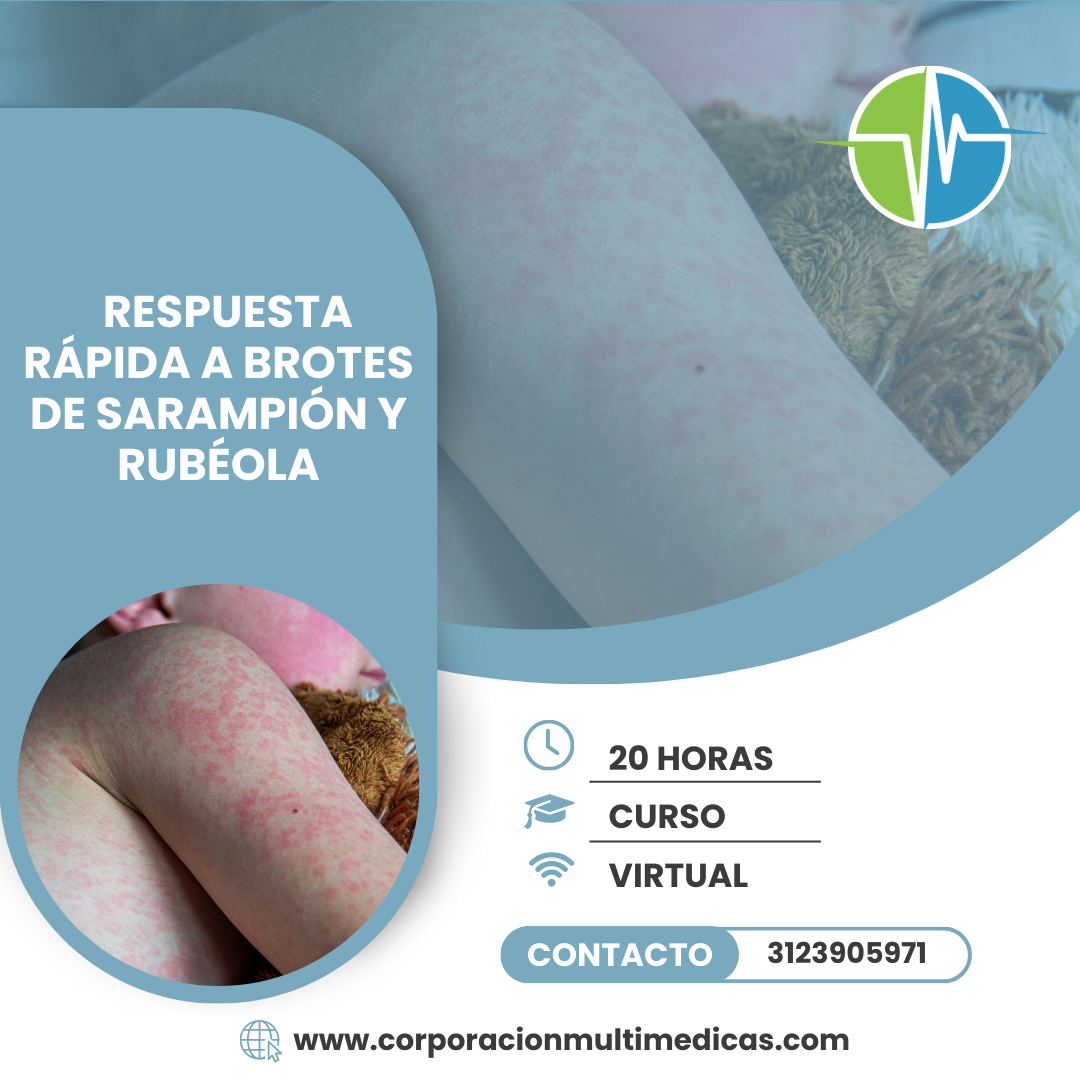 SARAMPION Y RUBEOLA